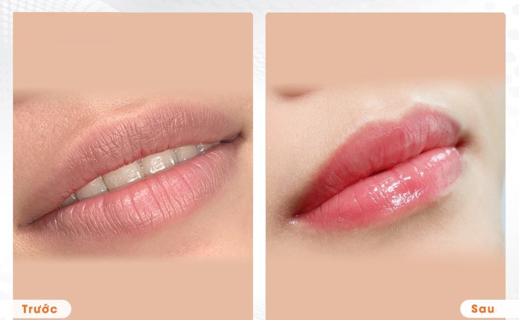 Trước và sau khi phun môi Ombre